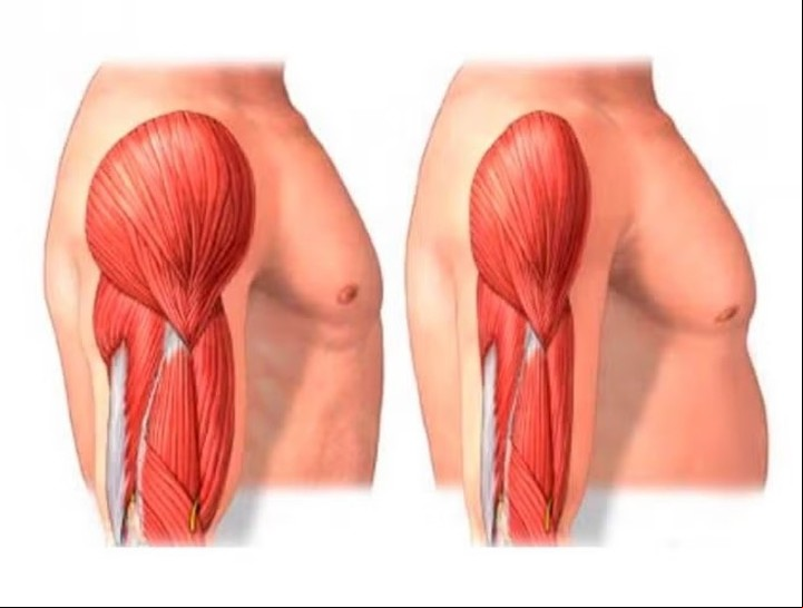 Ilustración que compara la masa muscular en un adulto.
